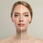 تصبغ الجلد أبو ظبي