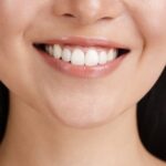 هل يُسبب تبييض الأسنان حساسية الأسنان في كثير من الأحيان؟