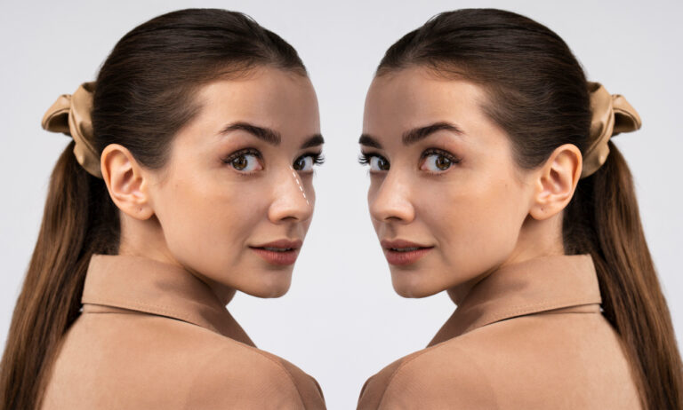 Face Framing