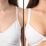 Breast-Augmentation-Prices-in-Dubai