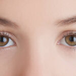 Can Eyelid Surgery Improve Vision Problems