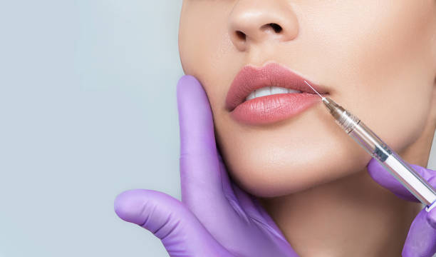 Can Russian lip Fillers fix uneven lips