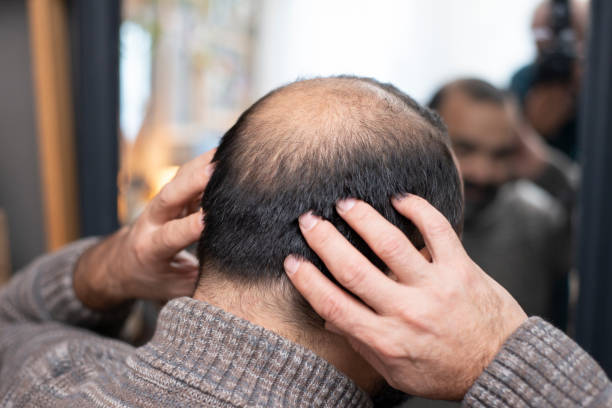 Does G Cell Treatment Help With Pigment and Texture Issues