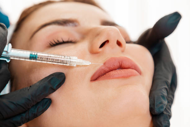 Does Lip Fillers Injection Improve Lip Shape