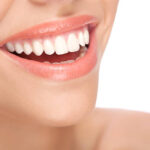 How Do You Choose the Right Dentist for E-Max Veneers