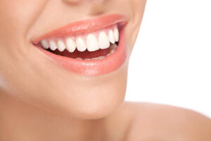 How Do You Choose the Right Dentist for E-Max Veneers