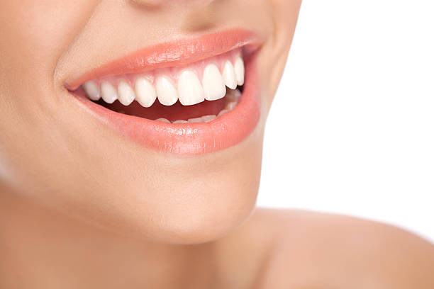 How Do You Choose the Right Dentist for E-Max Veneers