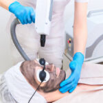 How Laser Carbon Peel Refreshes Dull Skin Fast