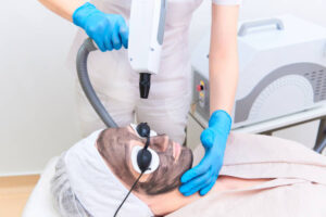 How Laser Carbon Peel Refreshes Dull Skin Fast