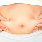 How Mini Abdominoplasty Can Restore a Youthful Abdomen Look