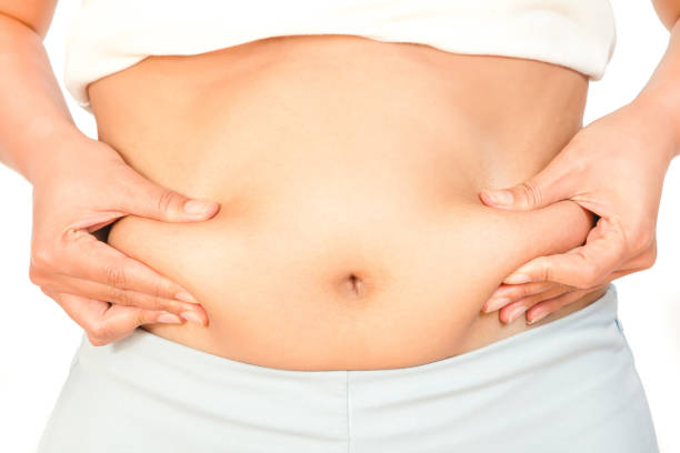 How Mini Abdominoplasty Can Restore a Youthful Abdomen Look
