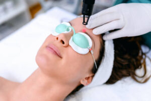 How Reliable Is Pico Laser for Skin Brightening