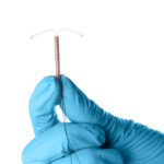 How Should You Care for Copper T After Placement