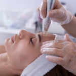 Is Fractional RF Micro Needling Safe for All Skin Tones