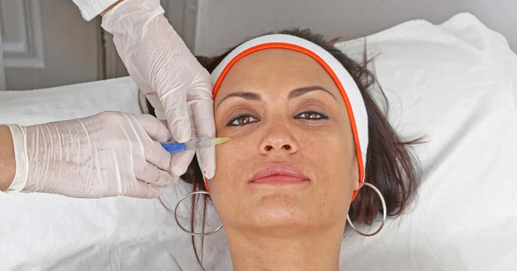 Under-Eye-Fillers_-All-You-Need-to-Know