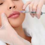 What Age Is Ideal for Russian Lip Fillers