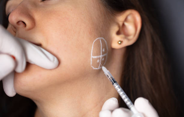 What Botox Can Do for Your Jawline