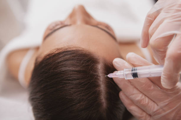 What Results Can Exosome Therapy Deliver on Scalp