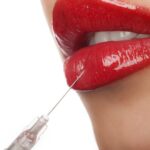 lip fillers in Dubai