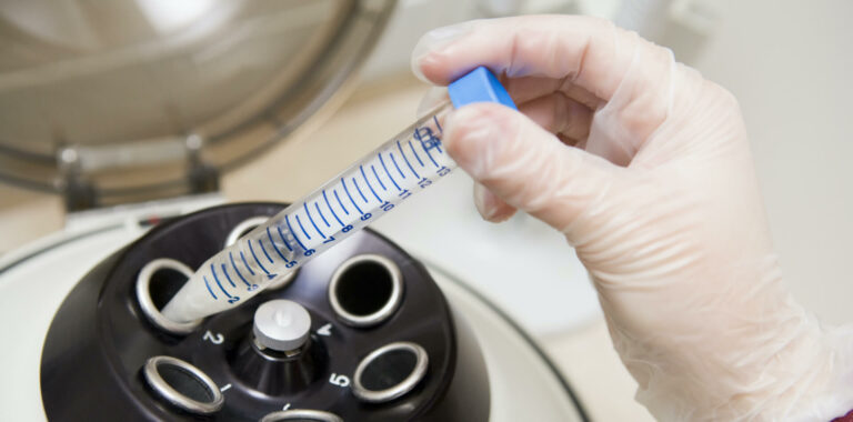 spermfreezing-sandiego-fertilityclinic-768x380