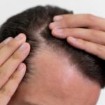 علاج الخلايا جي سيل في أبوظبي