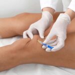 حقن الركبة PRP في أبوظبي