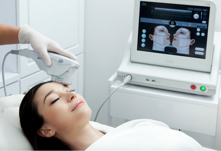 ultherapy bay area