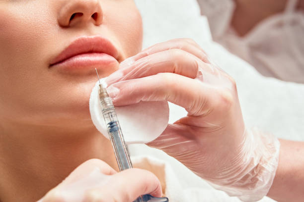 Can Lip Fillers Injection Improve Lip Symmetry