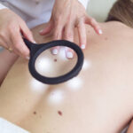 Can Wart Removal Stop Warts From Spreading Fast