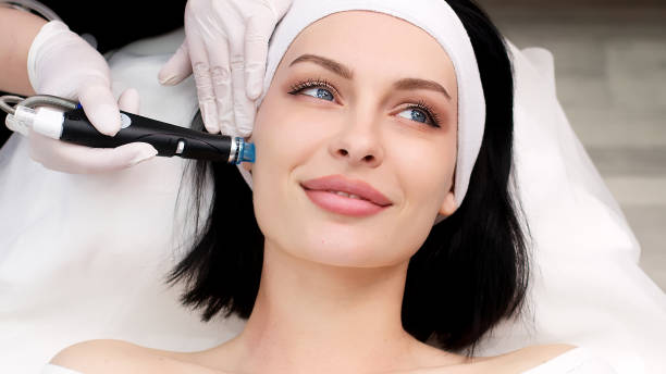 Can a Hydrafacial Near Me Remove Blackheads Effectively