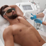 Can laser hair removal for men treat chest hair
