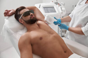 Can laser hair removal for men treat chest hair