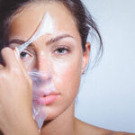 Does Chemical Peel Help Reduce Dark Spots