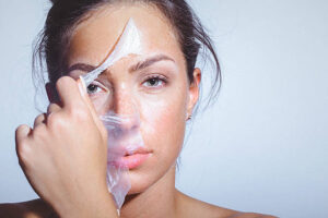 Does Chemical Peel Help Reduce Dark Spots