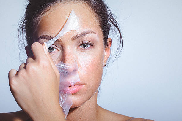 Does Chemical Peel Help Reduce Dark Spots