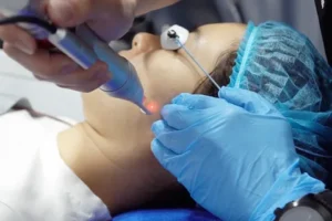 Does Endolift Require Multiple Sessions for Best Results