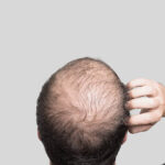Does GFC Treatment for Hair Deliver Long-Term Results