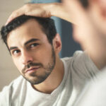 Does Hair Transplant Work for Bald Spots