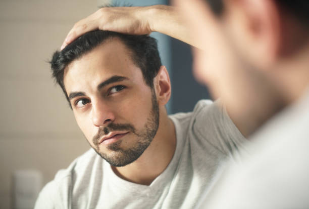 Does Hair Transplant Work for Bald Spots