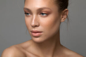 Does Melasma Treatment Work on Deep Spots