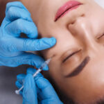 Does dermal fillers Improve Skin Smoothness and Volume