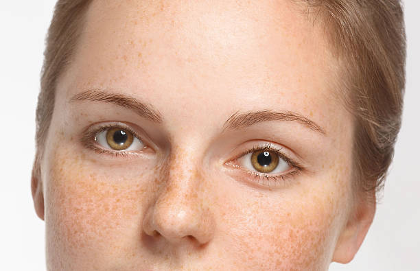 How Can Pigmentation Treatment Improve Facial Appearance