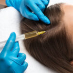 How Long Does Best PRP Hair Treatment Last