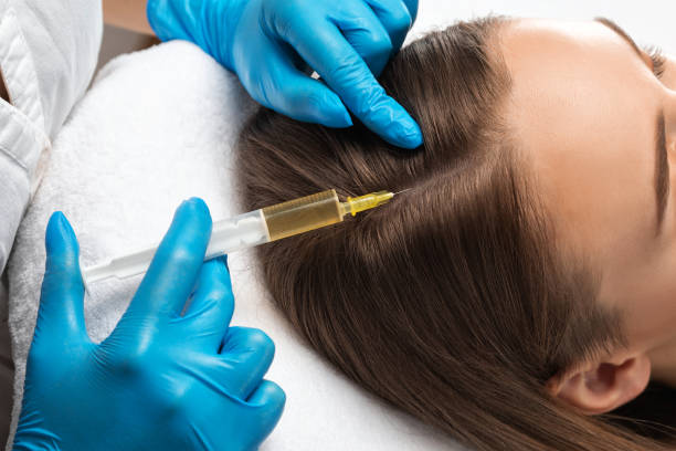 How Long Does Best PRP Hair Treatment Last