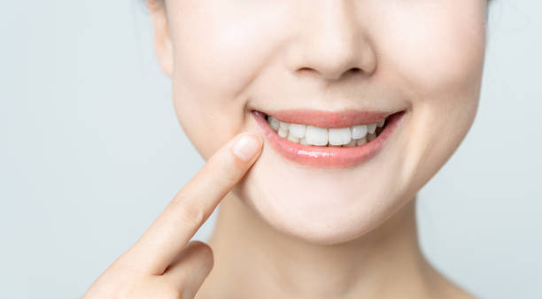 How Long Does Teeth Whitening Actually Last