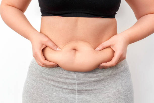 How Mini Abdominoplasty Enhances Your Natural Waistline