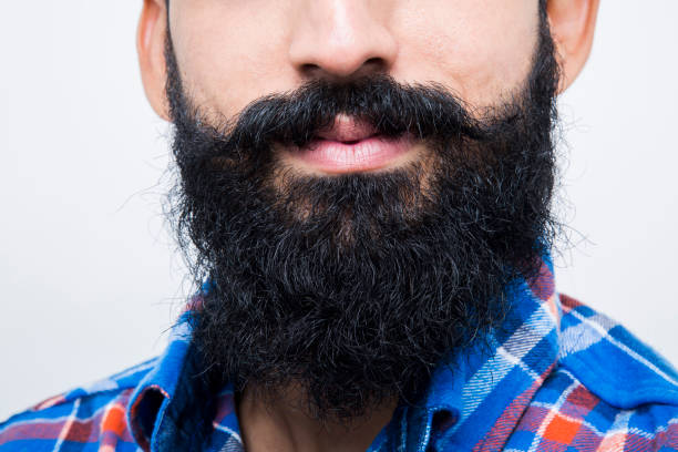 Is Beard Hair Transplant a Smart Fix for Thinning Facial Hair