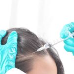 Is Best PRP Hair Treatment Effective for Receding Hairlines