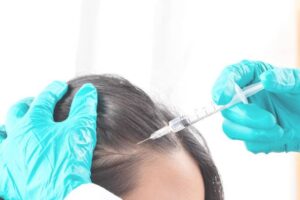 Is Best PRP Hair Treatment Effective for Receding Hairlines