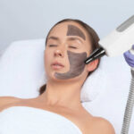 Is Laser Carbon Peel Safe for Sensitive Skin
